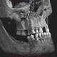 Image for article titled Modern Forensics Reveal Gruesome Details Of King Richard III's Death